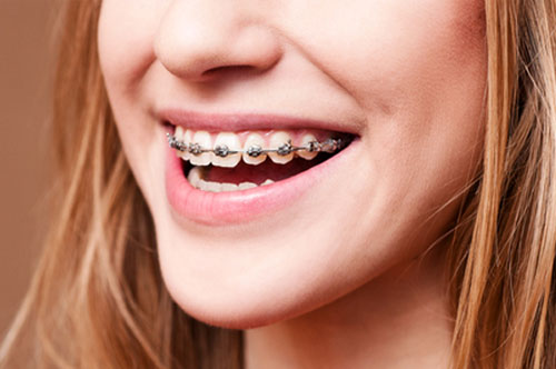 Keep Summer Fun From Turning Into Smile Setbacks