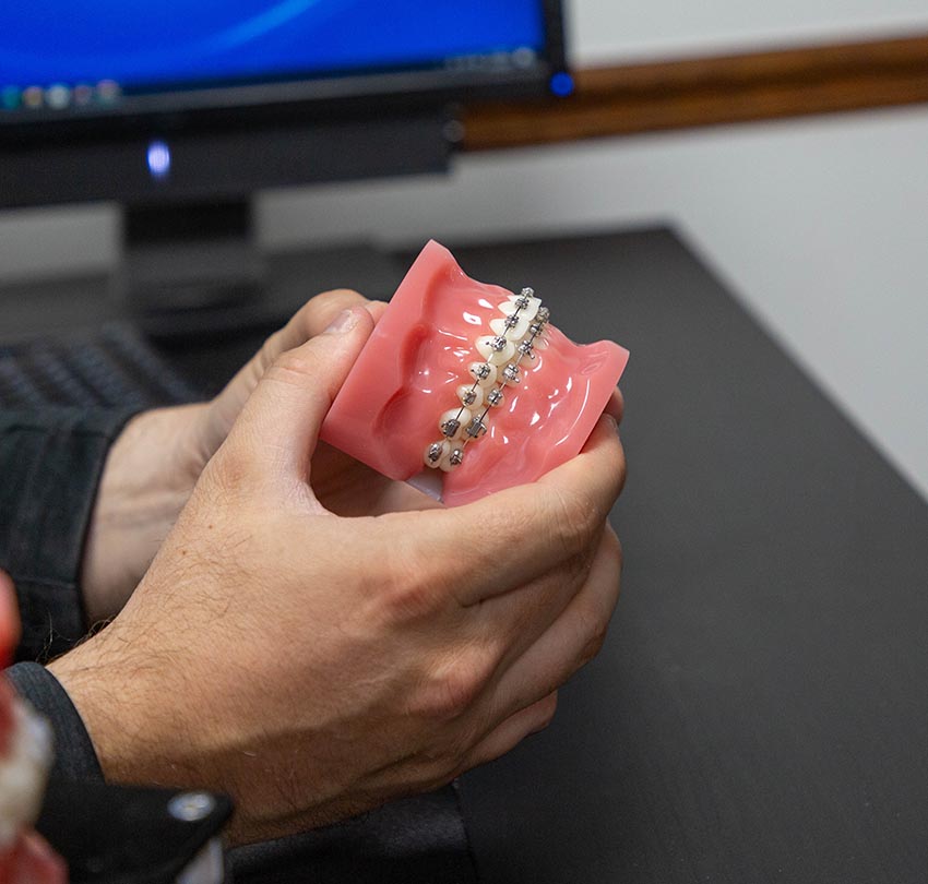 Braces Offer Comprehensive Solutions